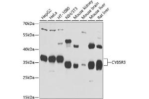Western blot analysis of extracts of various cell lines, using CYB5R3 antibody (ABIN6127675, ABIN6139298, ABIN6139299 and ABIN6223438) at 1:1000 dilution. (CYB5R3 Antikörper  (AA 125-334))