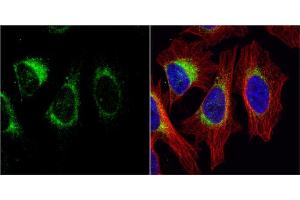 Immunofluorescence (IF) image for anti-Tyrosine Hydroxylase (TH) antibody (ABIN2855393)