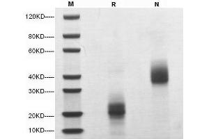 5 μg of M-CSF, Mouse was resolved with SDS-PAGE under reducing (R) and non-reducing (N) conditions and visualized by Coomassie Blue staining. (M-CSF/CSF1 Protein (AA 33-187))