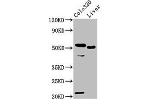 Western Blot Positive WB detected in: Colo320 whole cell lysate, Rat liver tissue All lanes: OLFM4 antibody at 10 μg/mL Secondary Goat polyclonal to rabbit IgG at 1/50000 dilution Predicted band size: 58 kDa Observed band size: 58 kDa (Olfactomedin 4 Antikörper  (AA 224-334))