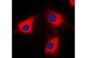 Immunofluorescent analysis of BCKDK staining in HeLa cells.