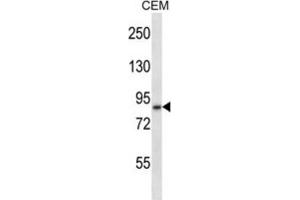 Western Blotting (WB) image for anti-ADAM Metallopeptidase Domain 11 (ADAM11) antibody (ABIN2997715) (ADAM11 Antikörper)
