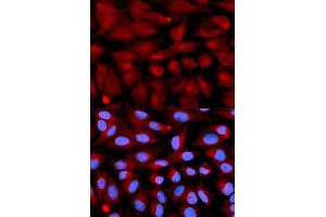 Immunofluorescence analysis of U2OS cell using CD70 antibody. (CD70 Antikörper  (AA 39-193))