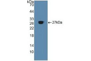 Detection of Recombinant ACO1, Human using Polyclonal Antibody to Aconitase 1 (ACO1) (Aconitase 1 Antikörper  (AA 251-443))