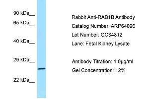 Western Blotting (WB) image for anti-RAB1B, Member RAS Oncogene Family (RAB1B) (C-Term) antibody (ABIN2774390) (RAB1B Antikörper  (C-Term))