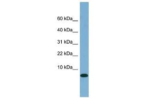 FABP1 antibody used at 1 ug/ml to detect target protein.