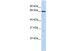 WB Suggested Anti-HAS3 Antibody Titration:  0.