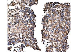 IHC analysis of Paxillin/PXN using anti-Paxillin/PXN antibody (ABIN7602636). (Paxillin Antikörper  (AA 9-570))