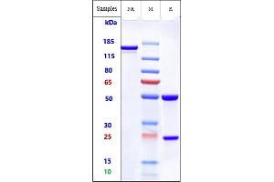 Anti-ROR2 Reference Antibody (Ozuriftamab) on SDS-PAGE under reducing (R) condition. (Rekombinanter ROR2 (Ozuriftamab Biosimilar) Antikörper)