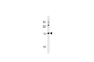 SSNA1 Antibody (N-term) (ABIN1881836 and ABIN2843441) western blot analysis in  cell line lysates (35 μg/lane). (SSNA1 Antikörper  (N-Term))