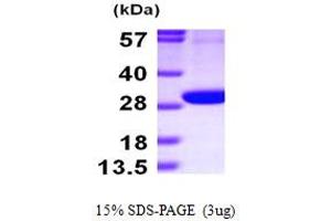 SDS-PAGE (SDS) image for 6-phosphogluconolactonase (PGLS) (AA 1-258) protein (His tag) (ABIN667246) (PGLS Protein (AA 1-258) (His tag))