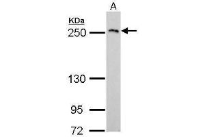 WB Image COL3A1 antibody [C2C3], C-term detects COL3A1 protein by Western blot analysis.