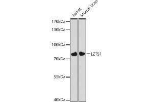 Western blot analysis of extracts of various cell lines, using LZTS1 antibody (ABIN7268226) at 1:3000 dilution. (LZTS1 Antikörper  (AA 337-596))