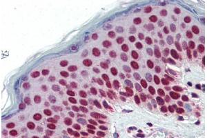 Human Skin (formalin-fixed, paraffin-embedded) stained with SETD7 antibody ABIN364315 at 5 ug/ml followed by biotinylated anti-mouse IgG secondary antibody ABIN481714, alkaline phosphatase-streptavidin and chromogen. (SETD7 Antikörper)