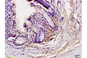 Formalin-fixed and paraffin embedded mouse liver tissue labeled with Anti-Phospho-GCN2 (Thr898) Polyclonal Antibody, Unconjugated (ABIN684943) at 1:200 followed by conjugation to the secondary antibody and DAB staining (GCN2 Antikörper  (pThr899))