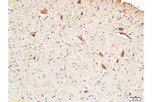 Immunohistochemistry (Paraffin-embedded Sections) (IHC (p)) image for anti-Fascin (FSCN1) (AA 11-110) antibody (ABIN728293)