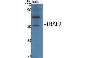 Western Blotting (WB) image for anti-TNF Receptor-Associated Factor 2 (TRAF2) (Internal Region) antibody (ABIN3187320) (TRAF2 Antikörper  (Internal Region))