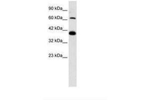 Image no. 2 for anti-Glutamate Receptor, Ionotropic, Kainate 2 (GRIK2) (AA 151-200) antibody (ABIN202320) (GRIK2 Antikörper  (AA 151-200))