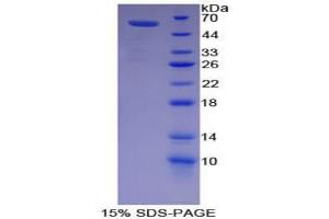 SDS-PAGE analysis of Pig Lipase, Hepatic Protein.