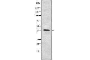 Western blot analysis of P2RY5 using HeLa whole cell lysates (LPAR6 Antikörper  (Internal Region))