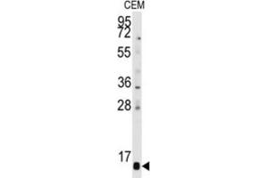 Western Blotting (WB) image for anti-Prefoldin Subunit 6 (PFDN6) antibody (ABIN3001660) (PFDN6 Antikörper)
