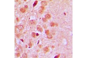Immunohistochemical analysis of CD75 staining in human brain formalin fixed paraffin embedded tissue section. (ST6GAL1 Antikörper  (Center))