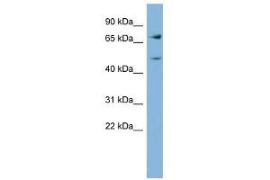GFPT2 antibody used at 1 ug/ml to detect target protein. (GFPT2 Antikörper  (Middle Region))