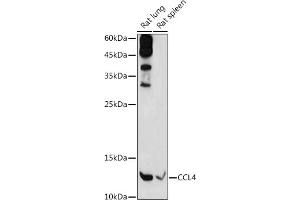 Western blot analysis of extracts of various cell lines, using CCL4 antibody (ABIN3022366, ABIN3022367, ABIN3022368 and ABIN6218763) at 1:1000 dilution. (CCL4 Antikörper  (C-Term))