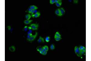 Immunofluorescence staining of MCF-7 cells with ABIN7166124 at 1:66, counter-stained with DAPI. (SHROOM2 Antikörper  (AA 213-405))