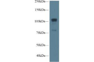 Western blot analysis of Human A549 cell lysate, using Rat NOS1 Antibody (1 µg/ml) and HRP-conjugated Goat Anti-Rabbit antibody (
