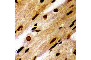 Immunohistochemical analysis of PSMB1 staining in mouse heart formalin fixed paraffin embedded tissue section. (PSMB1 Antikörper)