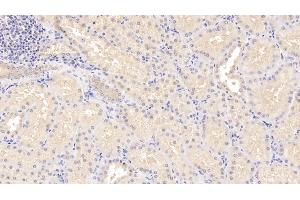 Detection of STC1 in Human Kidney Tissue using Polyclonal Antibody to Stanniocalcin 1 (STC1) (Stanniocalcin 1 Antikörper  (AA 28-247))