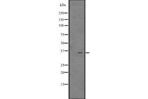 Western Blotting (WB) image for anti-Cbp/p300-Interacting Transactivator, with Glu/Asp-Rich Carboxy-terminal Domain, 4 (CITED4) (Internal Region) antibody (ABIN6258023)
