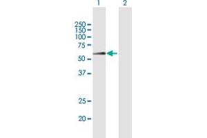 Western Blotting (WB) image for anti-SWI/SNF Related, Matrix Associated, Actin Dependent Regulator of Chromatin, Subfamily E, Member 1 (SMARCE1) (AA 1-411) antibody (ABIN948476)