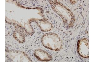 Immunoperoxidase of monoclonal antibody to ISGF3G on formalin-fixed paraffin-embedded human prostate.