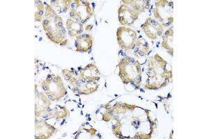 Immunohistochemistry of paraffin-embedded human gastric using RBP2 antibody at dilution of 1:100 (x40 lens). (RBP2 Antikörper)