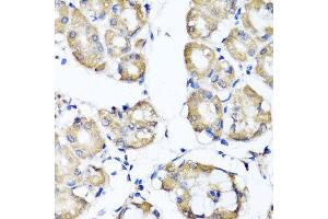Immunohistochemistry of paraffin-embedded human gastric using RBP2 antibody at dilution of 1:100 (x40 lens).