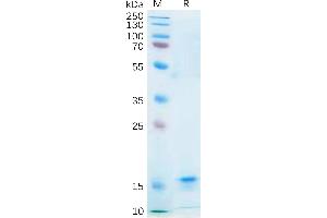SDS-PAGE (SDS) image for Interleukin 21 (IL21) (AA 30-162) protein (His tag) (ABIN7092721)