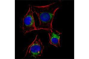 Immunofluorescence analysis of EC cells using NGFR mouse mAb (green). (NGFR Antikörper)