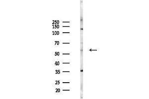 anti-Tripartite Motif Containing 68 (TRIM68) (C-Term) antibody