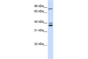 C18ORF10 antibody used at 1 ug/ml to detect target protein. (TPGS2 Antikörper  (Middle Region))