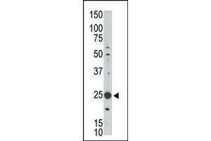 Western Blotting (WB) image for anti-Melanoma Antigen Family H, 1 (MAGEH1) (C-Term) antibody (ABIN358661) (MAGEH1 Antikörper  (C-Term))