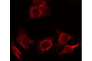 ABIN6278359 staining SW480 cells by ICC/IF. (MUC2 Antikörper)