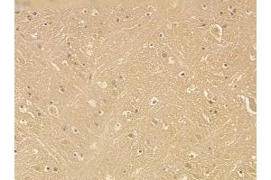 MAP2 Mouse Monoclonal Antibody at 1/100 staining mouse brain tissue by IHC-P. (MAP2 Antikörper  (C-Term))