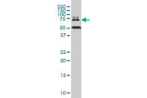 DKFZp727G131 monoclonal antibody (M01A), clone 1A3 Western Blot analysis of DKFZp727G131 expression in MCF-7 .