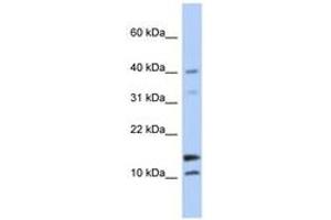 Image no. 1 for anti-WAP Four-Disulfide Core Domain 5 (WFDC5) (N-Term) antibody (ABIN6743675) (WFDC5 Antikörper  (N-Term))
