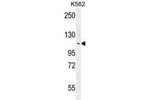 ANKRD18B Antibody (N-term) western blot analysis in K562 cell line lysates (35µg/lane). (ANKRD18B Antikörper  (N-Term))