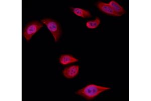 ABIN6258722 and ABIN6274757 staining Hela by IF/ICC. (RPS4Y1 Antikörper  (C-Term))