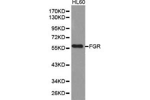 Western blot analysis of extracts of HL60 cell lines, using FGR antibody. (Fgr Antikörper  (AA 1-100))