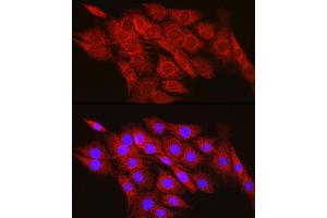 Immunofluorescence analysis of PC-12 cells using CPT2 Rabbit pAb (ABIN6129249, ABIN6138983, ABIN6138984 and ABIN6216045) at dilution of 1:100 (40x lens). (CPT2 Antikörper  (AA 1-180))